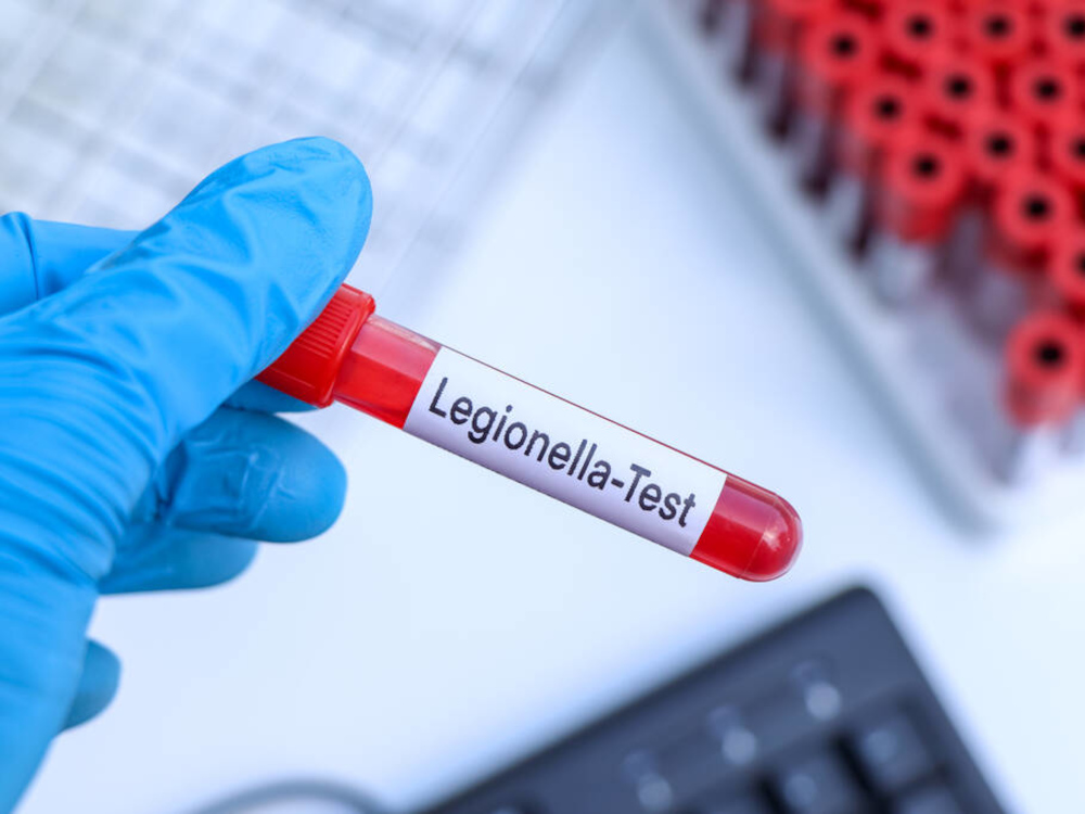 Legionella: o que as empresas devem cumprir